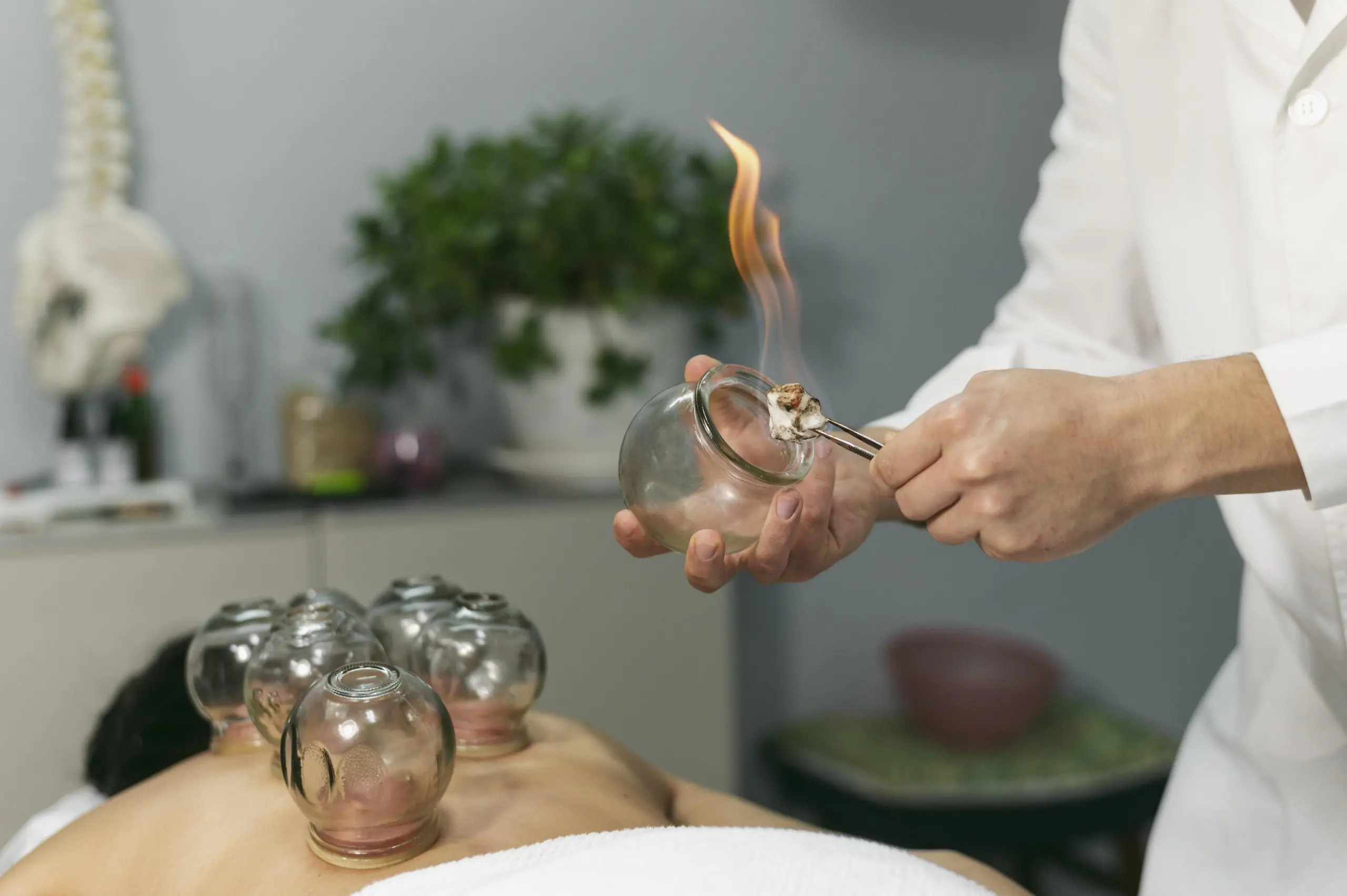 Cupping as part of holistic therapy
